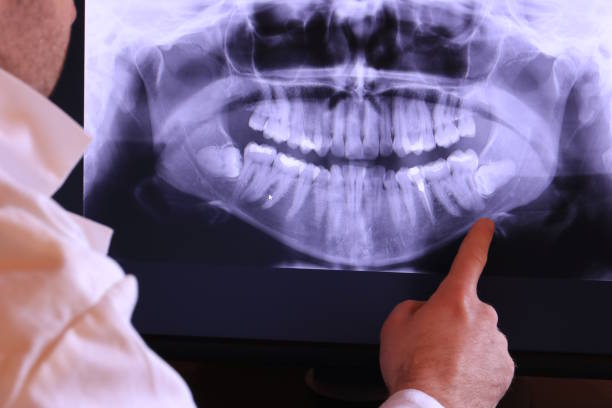 Best Knocked-Out Tooth Emergency  in Provo, UT