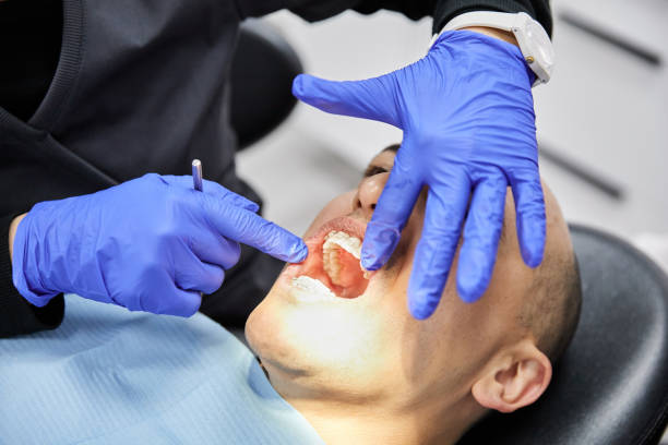 Best Teeth Whitening  in Provo, UT